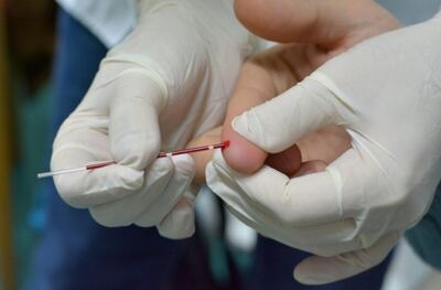 Necochea: Doble jornada gratuita y confidencial de testeos rápidos de HIV y Sífilis