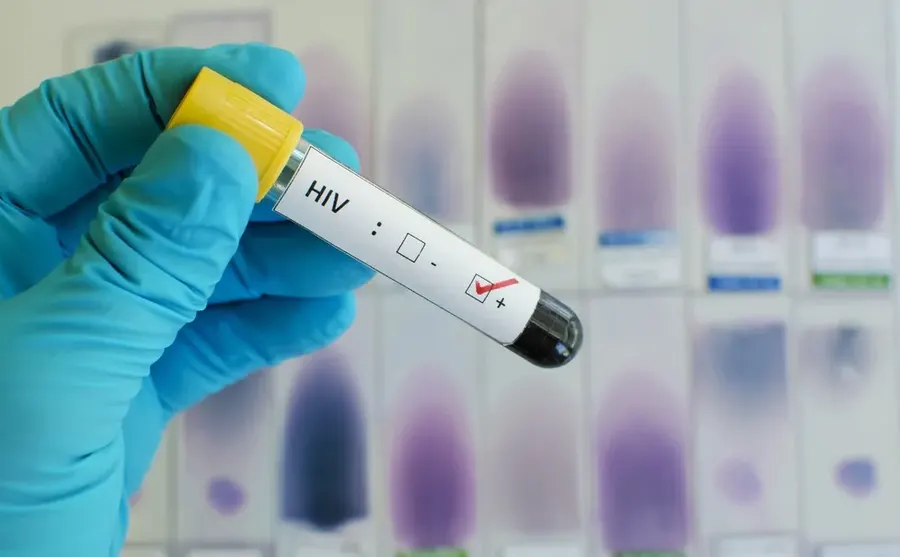 La Provincia cubrirá análisis para personas con VIH
