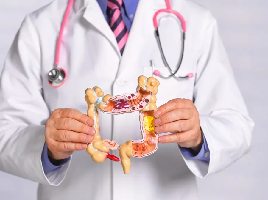Rojas: Comenzó la campaña preventiva del Cáncer de Cólon